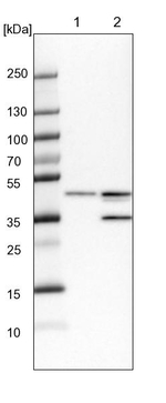 B4GALT3 Antibody in Western Blot (WB)