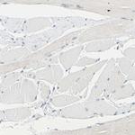 DCT Polyclonal Antibody