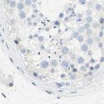 DCT Antibody in Immunohistochemistry (Paraffin) (IHC (P))