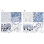DCT Antibody in Immunohistochemistry (IHC)