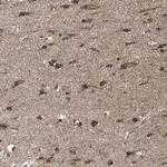 IGSF9B Antibody in Immunohistochemistry (Paraffin) (IHC (P))