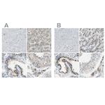 B4GALT1 Antibody in Immunohistochemistry (IHC)