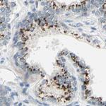 B4GALT1 Antibody in Immunohistochemistry (IHC)