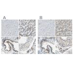 B4GALT1 Antibody in Immunohistochemistry (IHC)