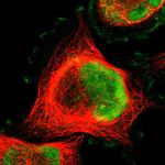 MLF2 Polyclonal Antibody