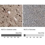 MLF2 Antibody in Immunohistochemistry (IHC)