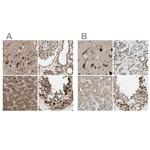 MLF2 Antibody in Immunohistochemistry (IHC)