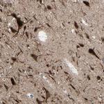 MLF2 Antibody in Immunohistochemistry (IHC)