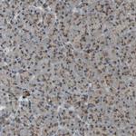 MLF2 Antibody in Immunohistochemistry (IHC)