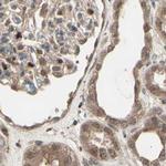 MLF2 Antibody in Immunohistochemistry (IHC)