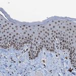 PHF2 Antibody in Immunohistochemistry (Paraffin) (IHC (P))