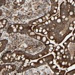 DHRS3 Antibody in Immunohistochemistry (Paraffin) (IHC (P))