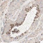 SPATA9 Antibody in Immunohistochemistry (Paraffin) (IHC (P))