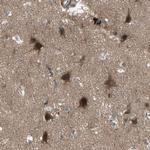 OSTM1 Antibody in Immunohistochemistry (Paraffin) (IHC (P))