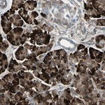 OSTM1 Antibody in Immunohistochemistry (Paraffin) (IHC (P))