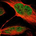 MLF2 Polyclonal Antibody