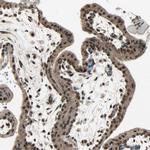 MLF2 Antibody in Immunohistochemistry (Paraffin) (IHC (P))