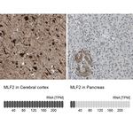 MLF2 Antibody in Immunohistochemistry (IHC)