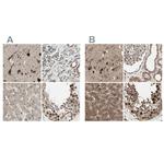 MLF2 Antibody in Immunohistochemistry (IHC)