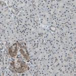 MLF2 Antibody in Immunohistochemistry (IHC)