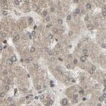 MLF2 Antibody in Immunohistochemistry (IHC)