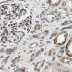 MLF2 Antibody in Immunohistochemistry (IHC)