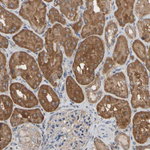 ALDH9A1 Antibody in Immunohistochemistry (Paraffin) (IHC (P))
