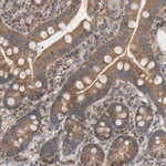 ALDH9A1 Antibody in Immunohistochemistry (Paraffin) (IHC (P))