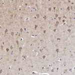 MGAT5 Polyclonal Antibody