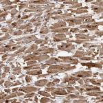 MGAT5 Antibody in Immunohistochemistry (Paraffin) (IHC (P))