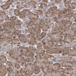 MGAT5 Antibody in Immunohistochemistry (Paraffin) (IHC (P))