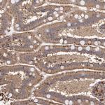 MGAT5 Antibody in Immunohistochemistry (Paraffin) (IHC (P))
