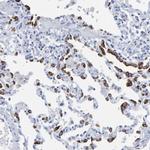 SFTPC Antibody in Immunohistochemistry (IHC)