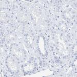 SFTPC Antibody in Immunohistochemistry (IHC)