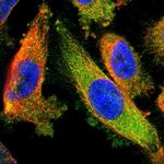 DPYSL3 Polyclonal Antibody