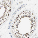 C2orf33 Antibody in Immunohistochemistry (Paraffin) (IHC (P))