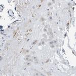 VMA21 Polyclonal Antibody