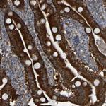 CCDC51 Antibody in Immunohistochemistry (Paraffin) (IHC (P))