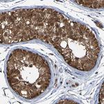 CCDC51 Antibody in Immunohistochemistry (Paraffin) (IHC (P))