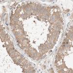 CCDC67 Polyclonal Antibody