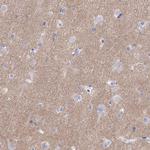 SYT12 Antibody in Immunohistochemistry (Paraffin) (IHC (P))