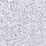 SYT12 Antibody in Immunohistochemistry (Paraffin) (IHC (P))