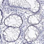 SYT12 Antibody in Immunohistochemistry (Paraffin) (IHC (P))