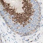 GOLGB1 Antibody in Immunohistochemistry (IHC)
