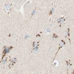 GOLGB1 Antibody in Immunohistochemistry (IHC)