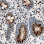 GOLGB1 Antibody in Immunohistochemistry (IHC)