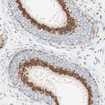 GOLGB1 Antibody in Immunohistochemistry (IHC)