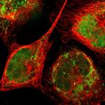 ZNF782 Polyclonal Antibody