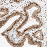ZNF782 Antibody in Immunohistochemistry (Paraffin) (IHC (P))