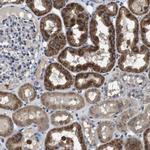 GLIPR1 Polyclonal Antibody